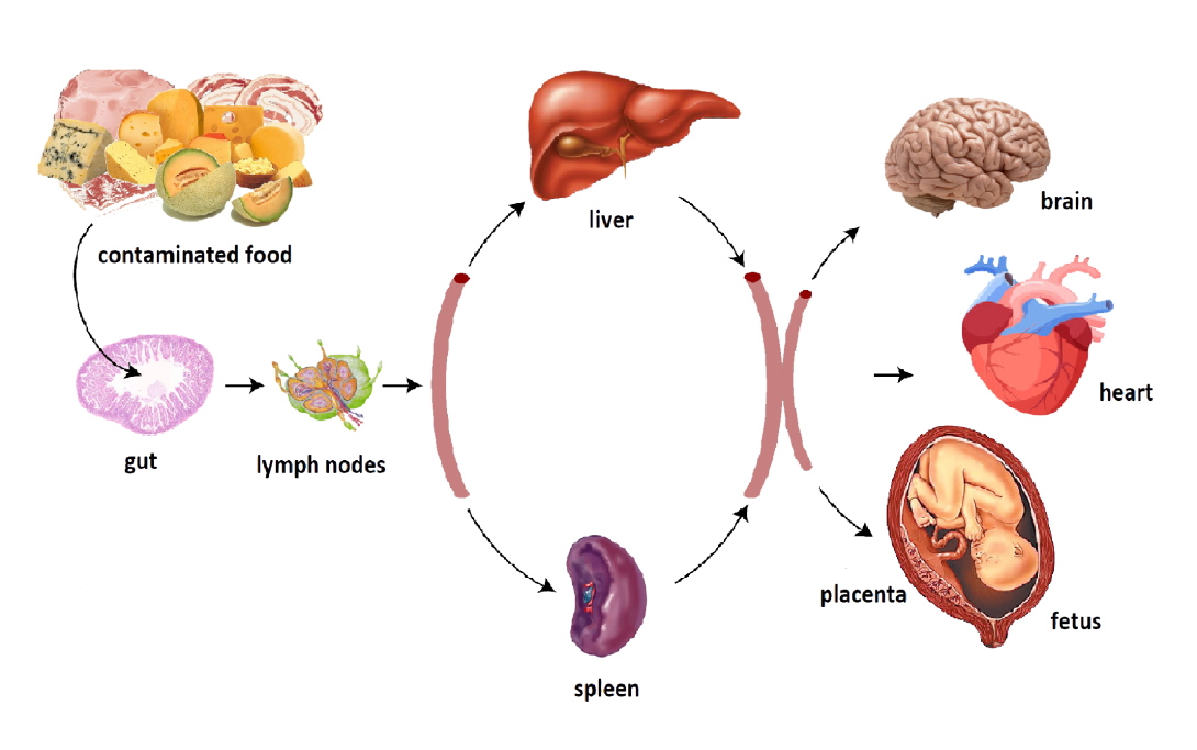 stages of listeria infection in humans, from ingestion of contaminated food to absorption listeria through the gut, passage through the liver and spleen and spread to brain, heart, and placenta and fetus