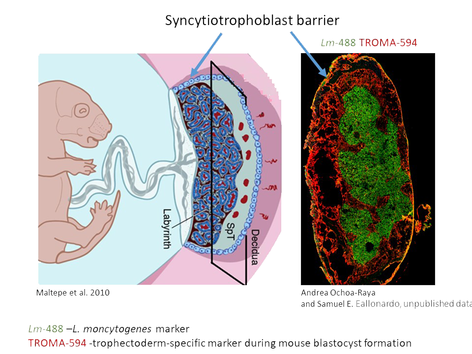 Schematic diagram of mouse fetus and placenta juxtaposed to a fluorescent microscopy image of the mouse placenta infected with Listeria